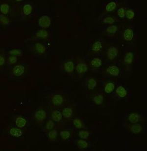 PCNA Monoclonal Antibody