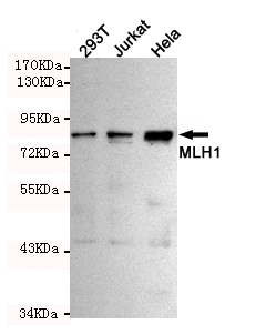 MLH1 Monoclonal Antibody