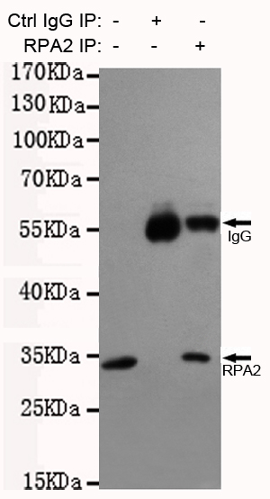 RPA32/RPA2 Monoclonal Antibody