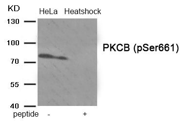 PKCB (Phospho-Ser661) Antibody