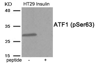 ATF1 (Phospho-Ser63) Antibody