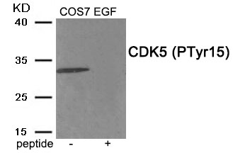 CDK5 (Phospho-Tyr15) Antibody