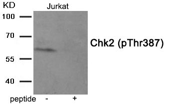 Chk2 (Phospho-Thr387) Antibody