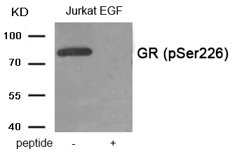 GR (Phospho-Ser226) Antibody