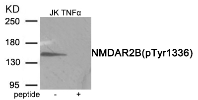 NMDAR2B (Phospho-Tyr1336) Antibody