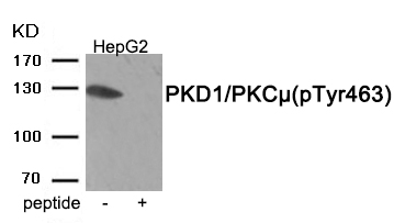 PKD1/PKC μ (Phospho-Tyr463) Antibody