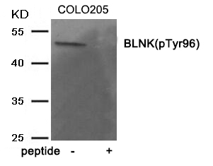 BLNK (Phospho-Tyr96) Antibody