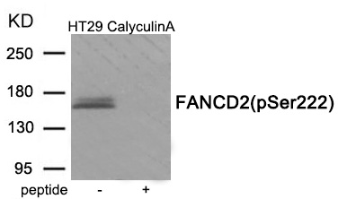 FANCD2 (Phospho-Ser222) Antibody