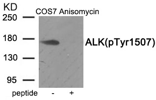 ALK (Phospho-Tyr1507) Antibody