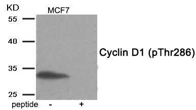 Cyclin D1 (Phospho-Thr286) Antibody