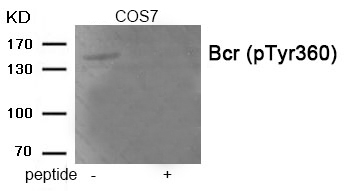 Bcr (Phospho-Tyr360) Antibody