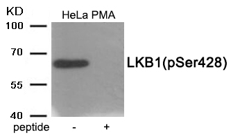 LKB1 (Phospho-Ser428) Antibody