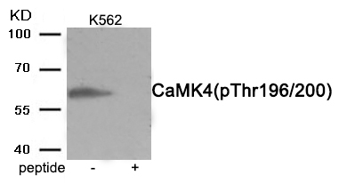 CaMK4 (Phospho-Thr196/200) Antibody