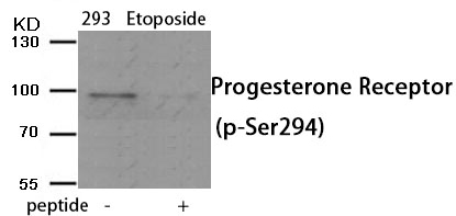 Progesterone Receptor (Phospho-Ser294) Antibody