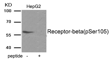 Estrogen Receptor- beta (Phospho-Ser105) Antibody