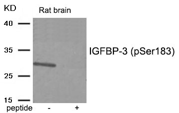 IGFBP-3 (Phospho-Ser183) Antibody