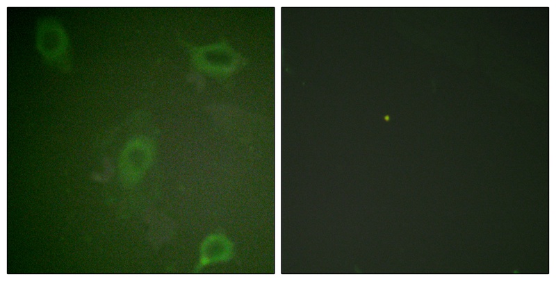 Amyloid β A4 (Phospho-Thr743/668) Antibody