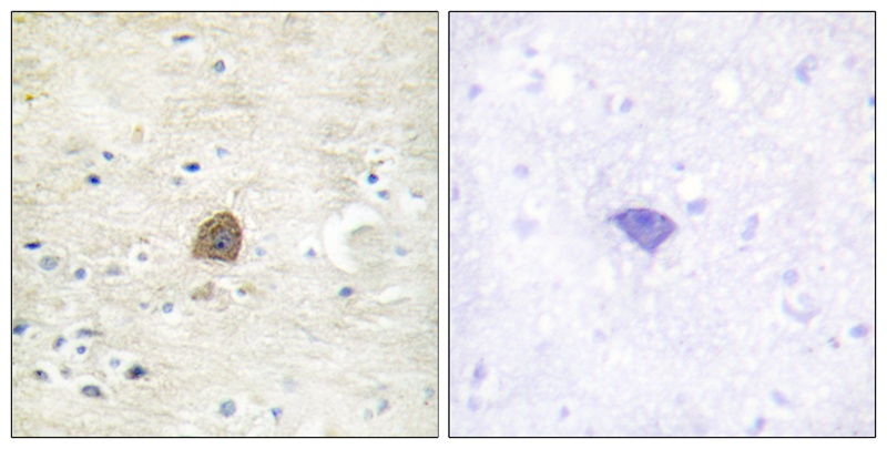 CaMK2α/β/δ (Phospho-Thr305) Antibody