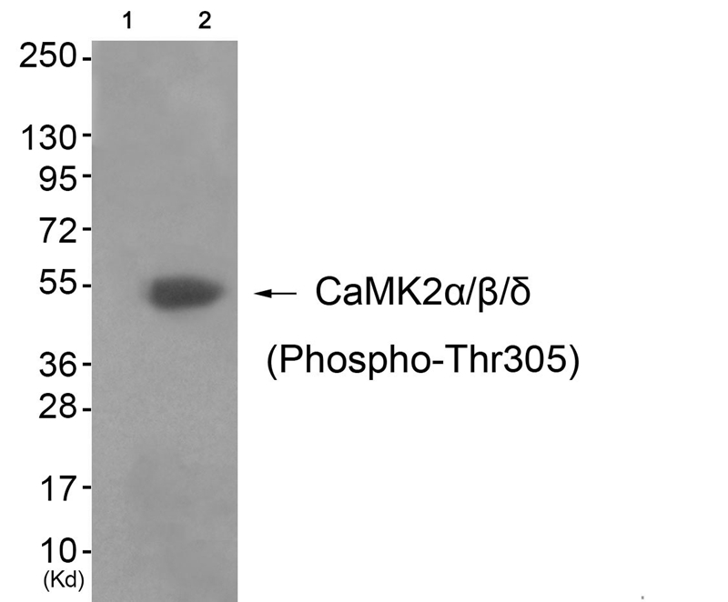 CaMK2α/β/δ (Phospho-Thr305) Antibody