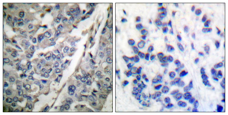 Synaptotagmin (Phospho-Thr202) Antibody