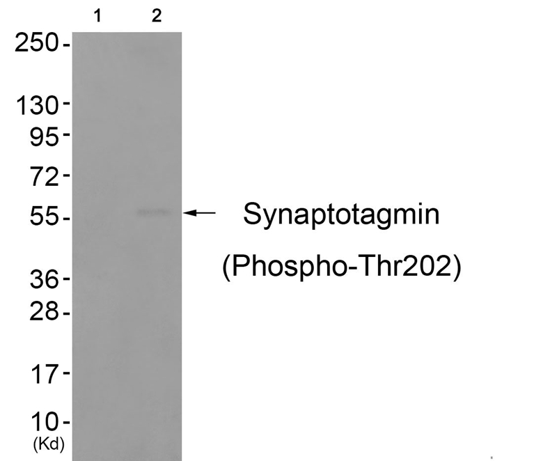 Synaptotagmin (Phospho-Thr202) Antibody