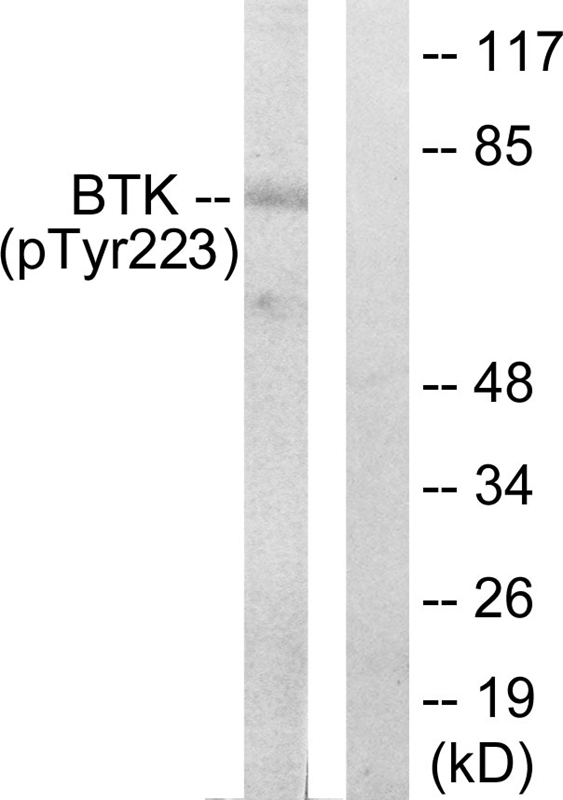 BTK (Phospho-Tyr223) Antibody