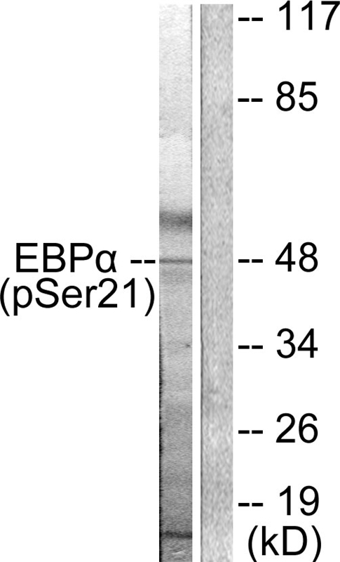 C/EBP-α (Phospho-Ser21) Antibody