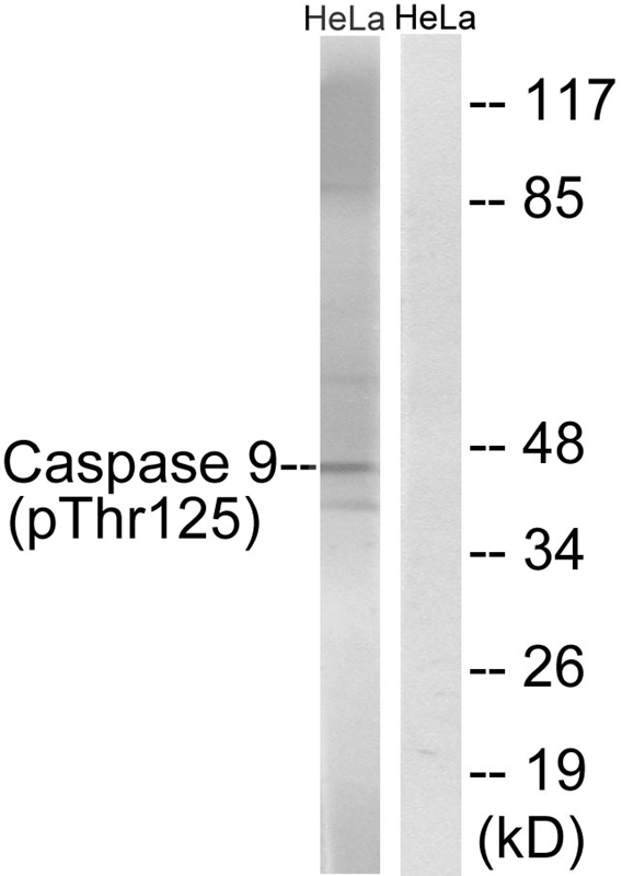 Caspase 9 (Phospho-Thr125) Antibody