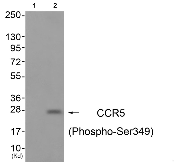 CCR5 (Phospho-Ser349) Antibody