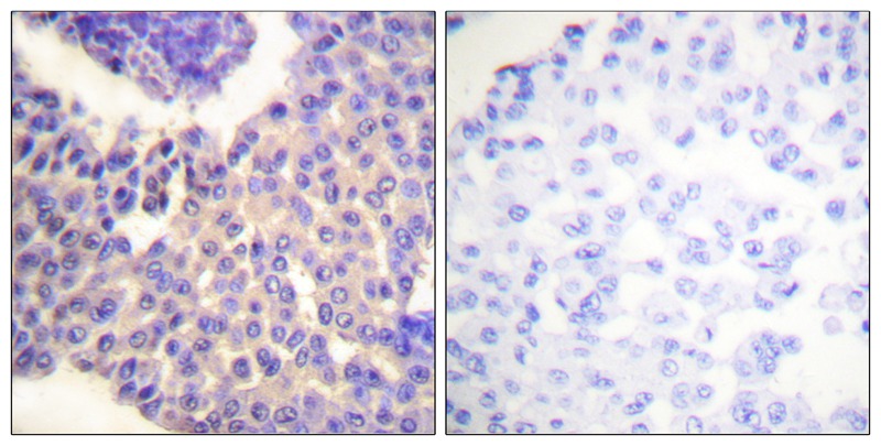 Arrestin 1 (Phospho-Ser412) Antibody