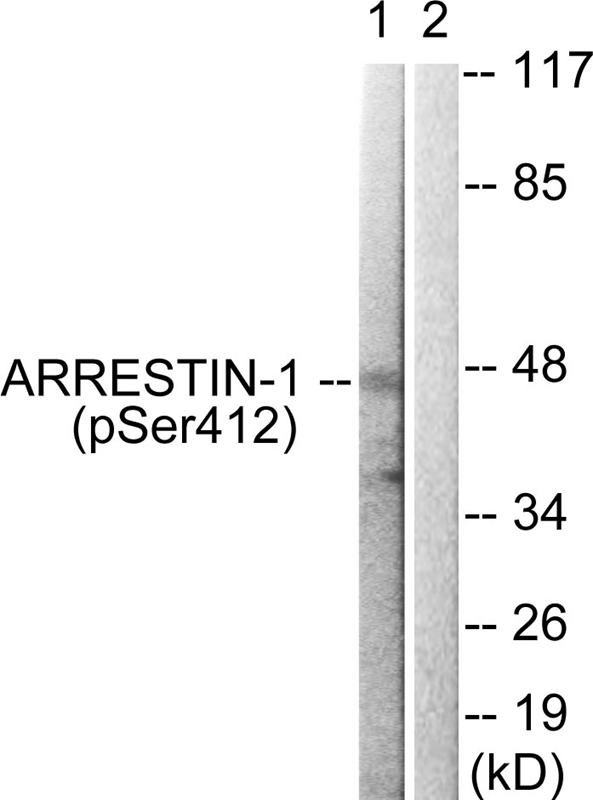 Arrestin 1 (Phospho-Ser412) Antibody