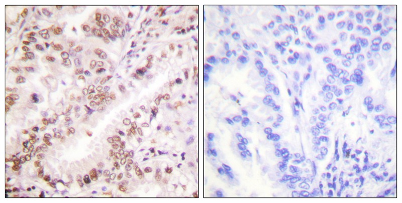 Estrogen Receptor-α (Phospho-Tyr537) Antibody