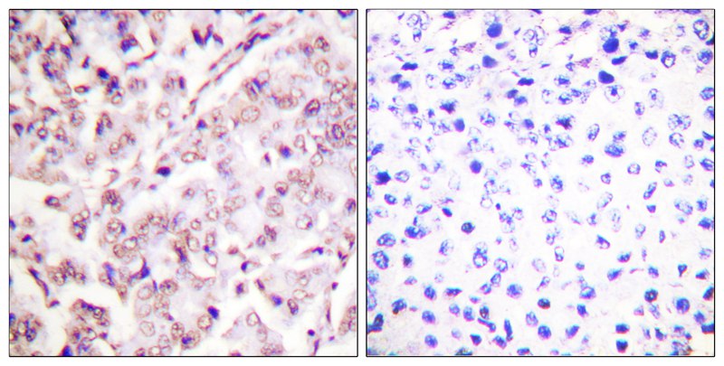 ETS1 (Phospho-Thr38) Antibody