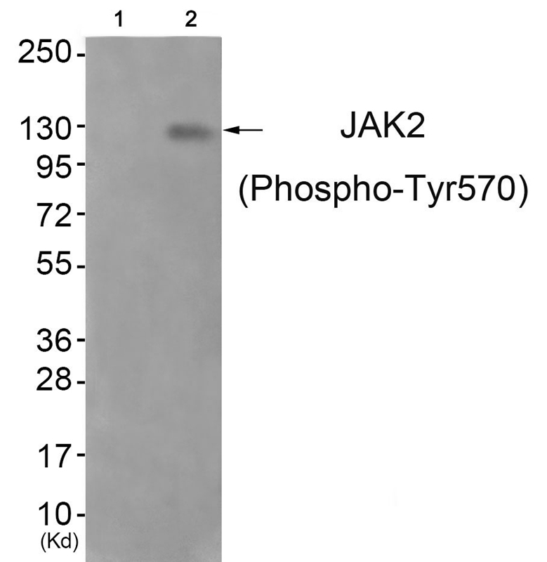 JAK2 (Phospho-Tyr570) Antibody