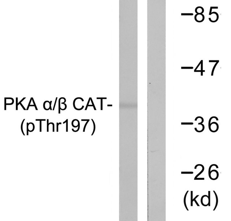 PKA α/β CAT (Phospho-Thr197) Antibody