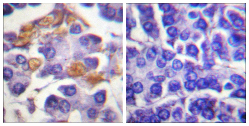 C-RAF (Phospho-Tyr341) Antibody