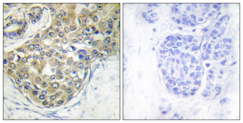 ACK1 (Phospho-Tyr284) Antibody