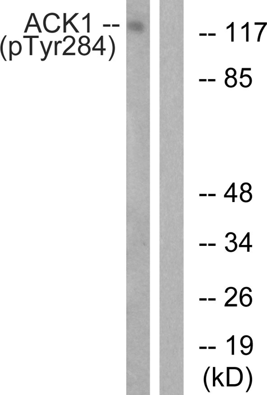 ACK1 (Phospho-Tyr284) Antibody