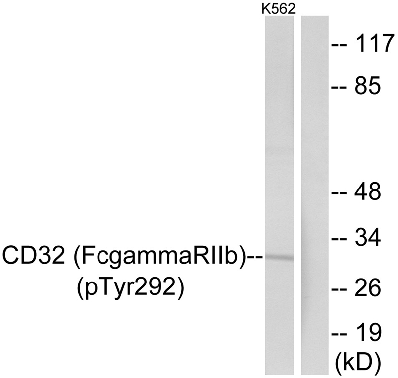 CD32 (Phospho-Tyr292) Antibody