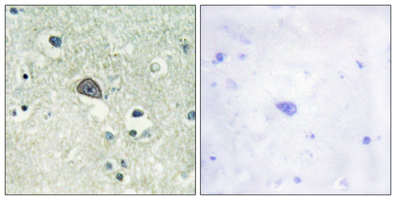 NMDAR1 (Phospho-Ser890) Antibody