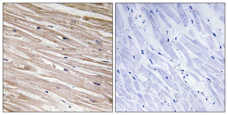 PEA-15 (Phospho-Ser104) Antibody