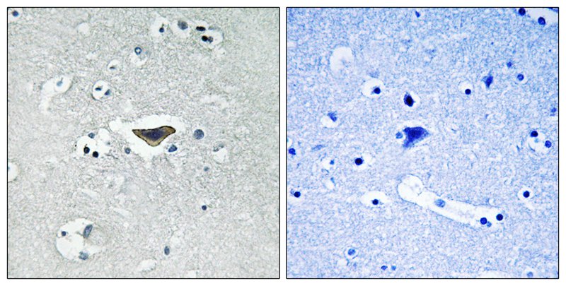 Ras-GRF1 (Phospho-Ser916) Antibody