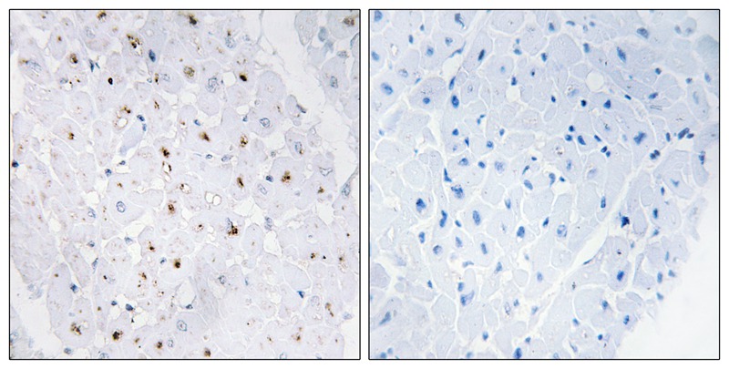 Bloom Syndrome (Phospho-Thr99) Antibody