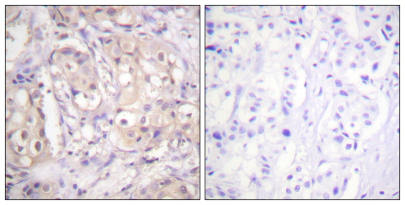 B-RAF (Phospho-Thr599) Antibody