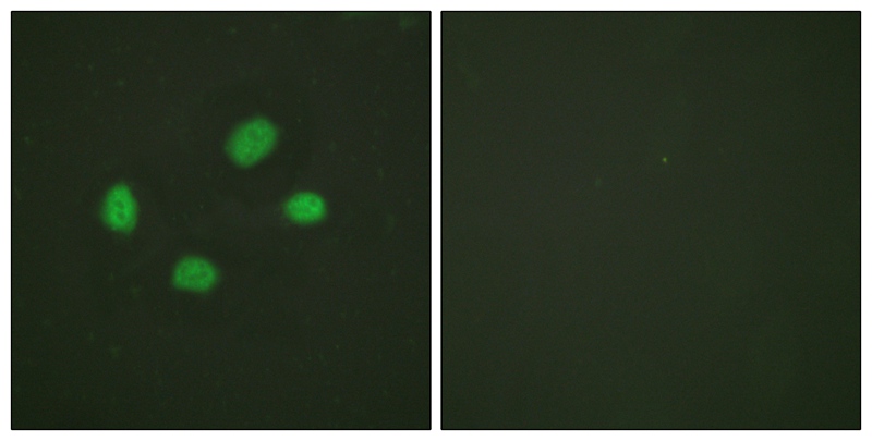 Chk2 (Phospho-Thr383) Antibody