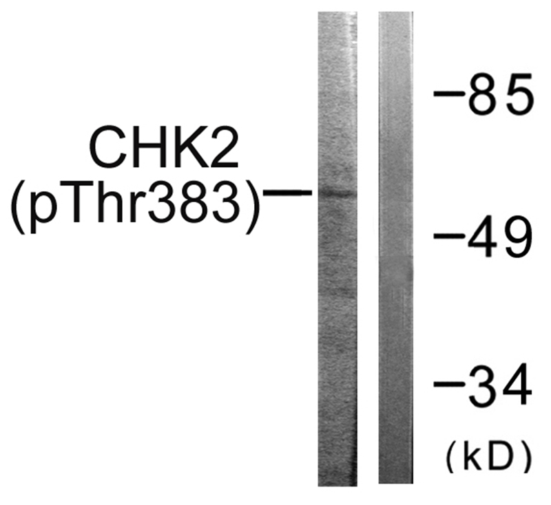 Chk2 (Phospho-Thr383) Antibody