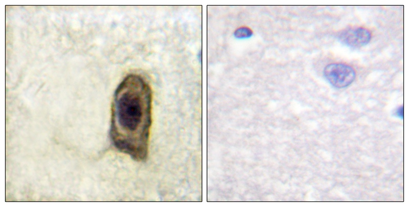 CSFR (Phospho-Tyr561) Antibody