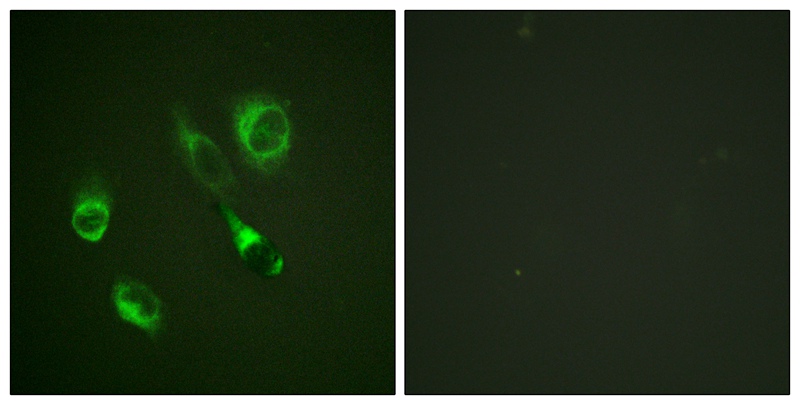 EPHA2/3/4 (Phospho-Tyr588/596) Antibody