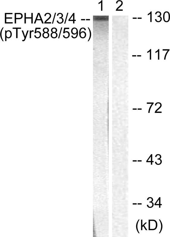 EPHA2/3/4 (Phospho-Tyr588/596) Antibody