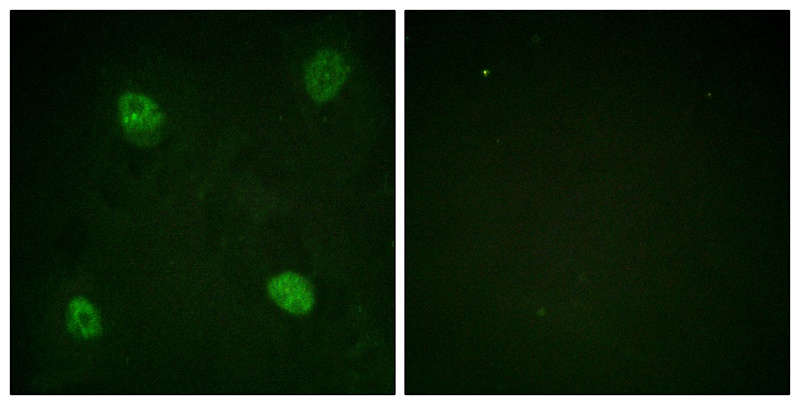 hnRPD (Phospho-Ser83) Antibody